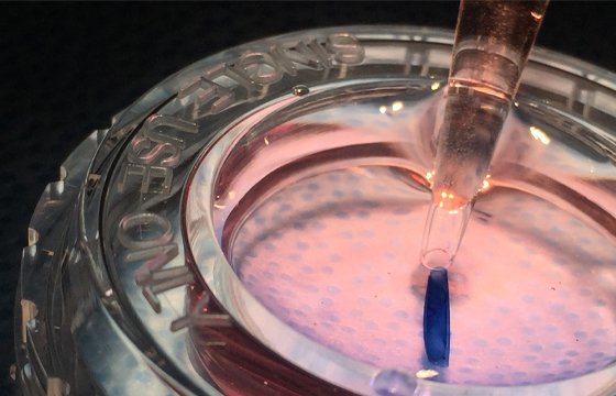 Amnion/Chorion Allograft