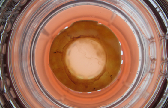 Amnion/Chorion Allograft