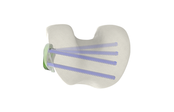 Derot option laterale dessous 1.1