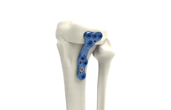 Fermeture tibiale Lateral T2 Coupe horizontal GAUCHE