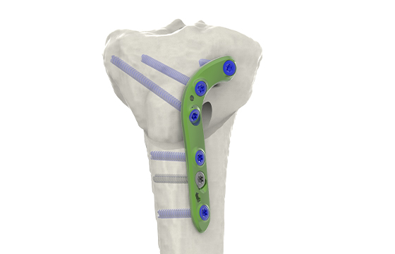 Slope-T2 INFRA E.7 3.14