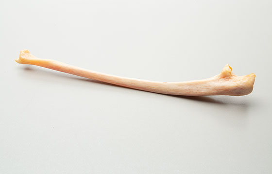 Ulna